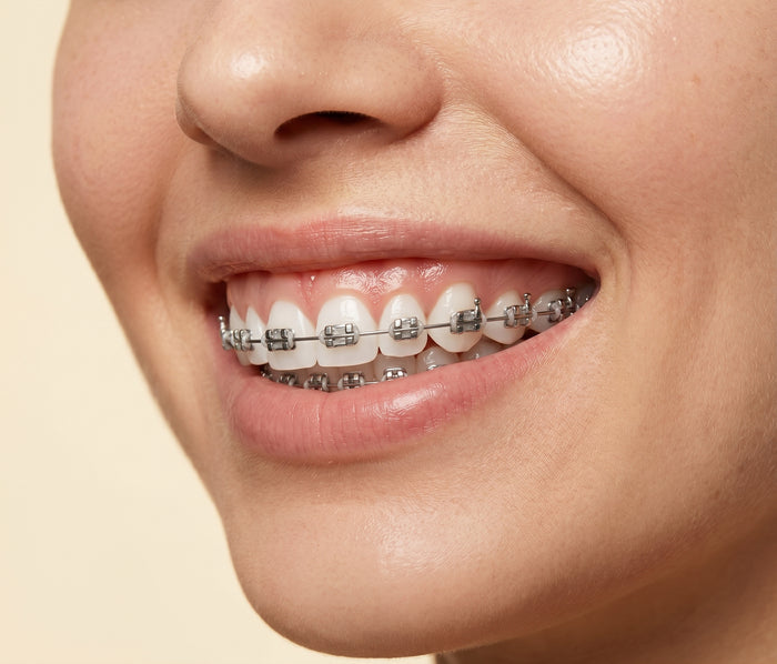 Adecuado para ortodoncia o dientes sensibles
